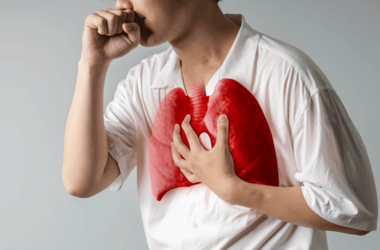 Featured-Image-Malaysias-Battle-with-Tuberculosis-Continues-How-to-Stay-Safe-and-Protected-770x507-1-1